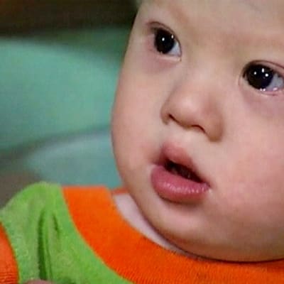 Australialaispariskunnan hylkäämä Downin syndroomaa sairastava vauva.
