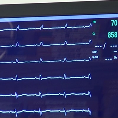 Sydänkäyriä monitorissa.