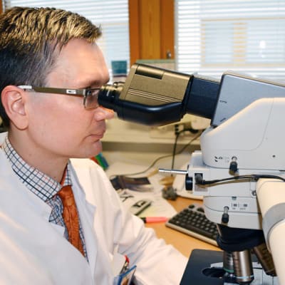 Patologian ylilääkäri Taneli Tani etsii mikroskoopilla syöpäsoluja imusolmukenäytteestä.