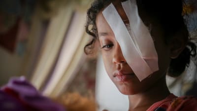 åttaåriga Razan blev skadad i ett flyganfall