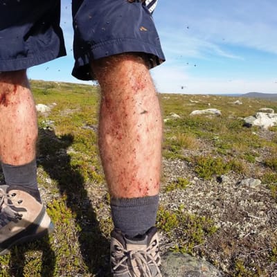 Sääskien syömät jalat