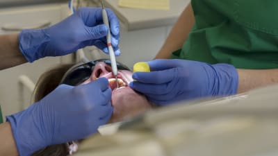 Patients tänder fixas hos tandläkaren