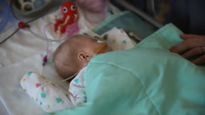 Pieni vauva nykkuu sairaalasängyssä vihreän peiton alla. Hengitysviikset on kiinnitetty kasvoille teipillä. Äiti silittää vauvaa peiton päältä.