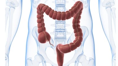 Tecknad bild som visar tjocktarmens läge i kroppen.