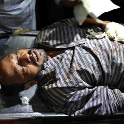 Iskussa haavoittunut bloggaaja Ranadipam Basu sairaalassa Dhakassa, Bagladeshissa 31. lokakuuta.