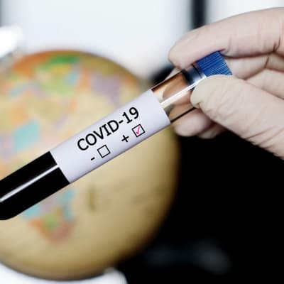 Hansikoitu käsi pitelee verta sisältävää koeputkea, jonka tarrassa on rasti osoittamassa, että COVID-19 testi on positiivinen. Taustalla maapallo. 