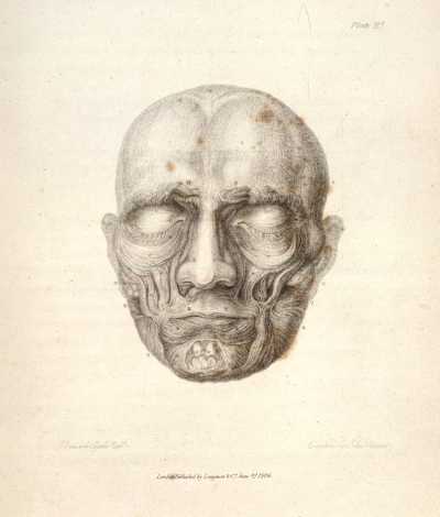 Piirros kasvoista. Tekijä: Bell, Charles. Essays on the Anatomy of Expression in Painting; The muscles of the face.