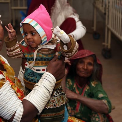 Nälkäänäkevä lapsi odotti hoitoa Tharparkarissa, Pakistanissa 27. tammikuuta 2015.