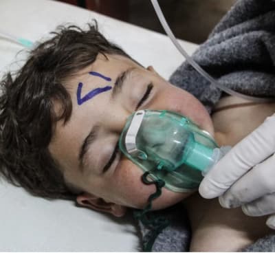A child receiving treatments after poison gas attack.