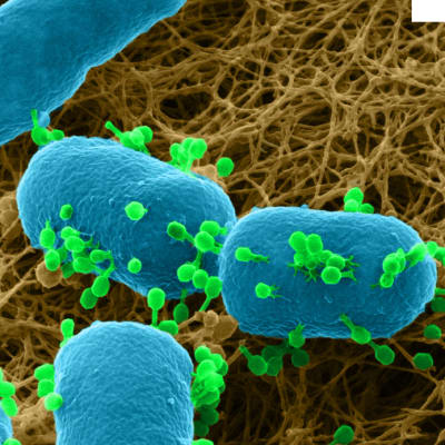 Mikroskooppikuva faagista ja bakteerista.