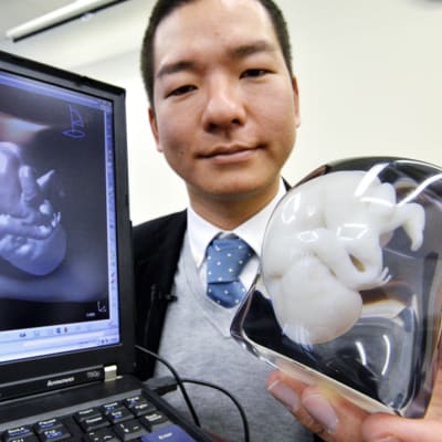 Fasotec-yhtiön edustaja esittelee sikiöstä tehtyä 3D-mallia.