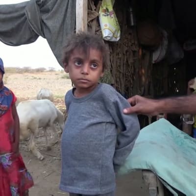 Jemenissä pelätään laajaa nälänhätää - 10-vuotias Hassan sai apua, mutta kotikylässä ruokaa ei riitä tarpeeksi