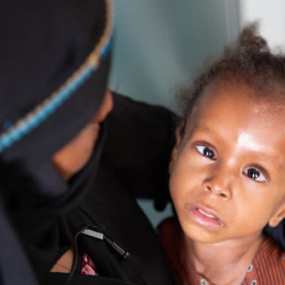 Svältande barn i Jemen