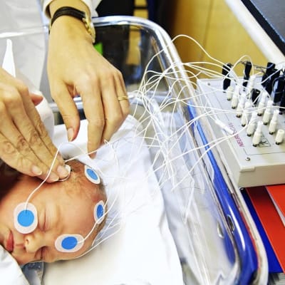 Aivosähkökäyrän mittaus vauvalla