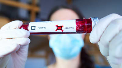 En person med skyggsmask håller upp en röd testtub med "negative" ikryssat.