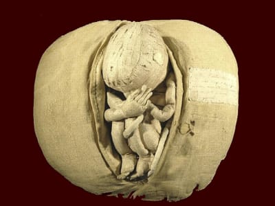 En anatomisk modell från 1700-talets senare hälft av en kvinnas livmoder och ett foster, med navelsträng. 