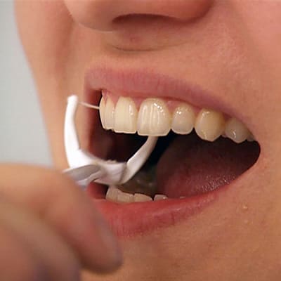Hammasvälejä puhdistetaan hammaslangalla