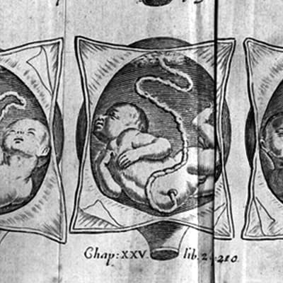 Gammal bild av foster i livmodern