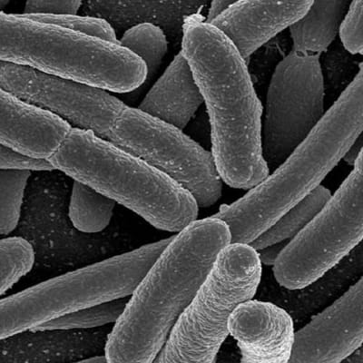 e-coli