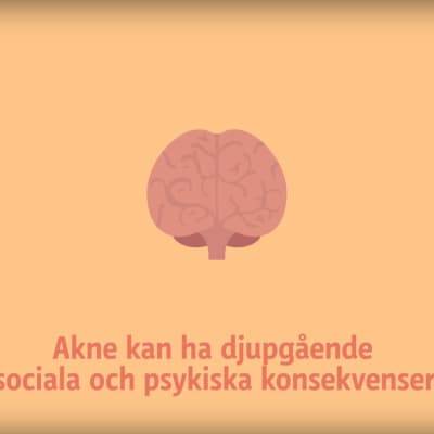 x3makne
