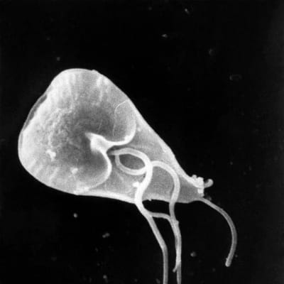 Pyyhkäisyelektronimikroskooppikuva Giardia lamblia -loisesta. Millimetrin sadasosan pituinen, yksisoluinen eläin liikkuu kuvassa näkyvien siimojen avulla. 