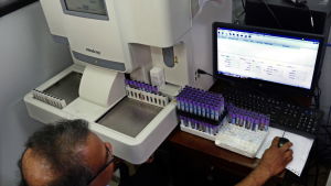 Laboratorieprover analyseras. Man som analyserar laboratorieprover pga denguefeber
