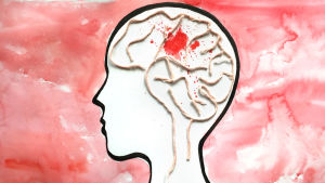 Piirros, pää jossa aivot villalangasta