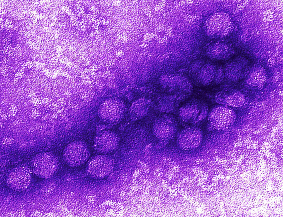 Länsi Niilin Virus Oireet