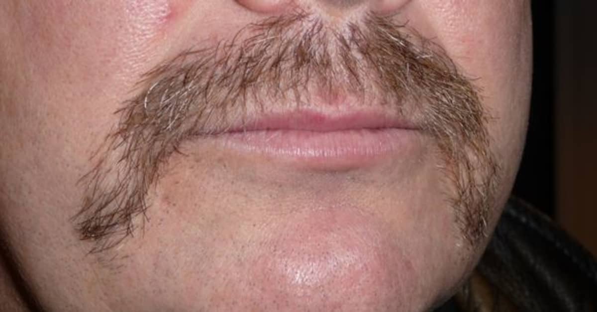 Финские мужчины весь месяц не брили усы в знак солидарности c больными ...