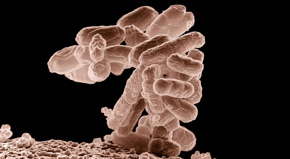 Sauvamaisia bakteereja päällekkäin kasautuneina. Kolibakteerien ryväs näyttää tällaiselta, kun sen suurentaa mikroskoopissa kymmentuhatkertaiseksi.