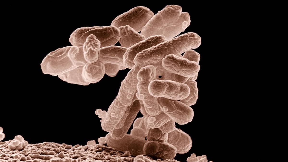 Sauvamaisia bakteereja päällekkäin kasautuneina. Kolibakteerien ryväs näyttää tällaiselta, kun sen suurentaa mikroskoopissa kymmentuhatkertaiseksi.