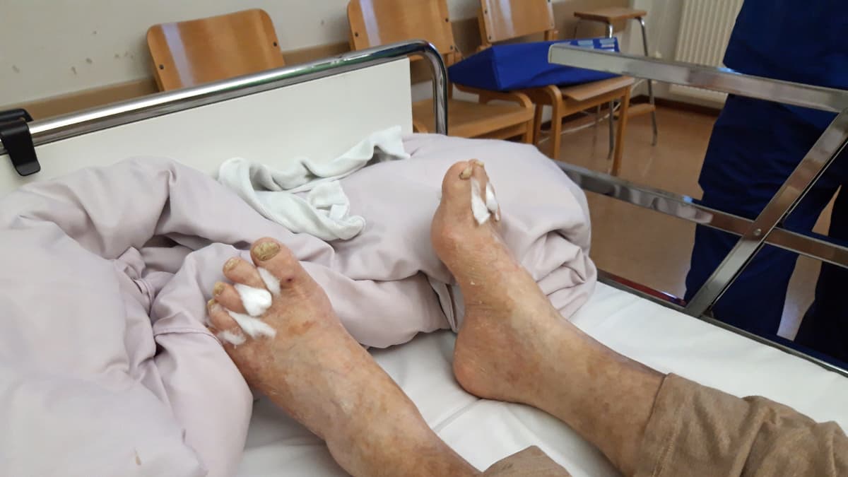 Kuvassa vuoteessa makaavan iäkkään potilaan jalat.