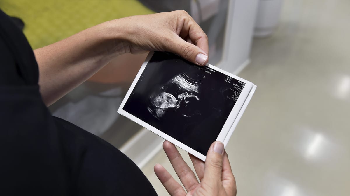 Raskaana oleva nainen katsoo ultraäänikuvia.