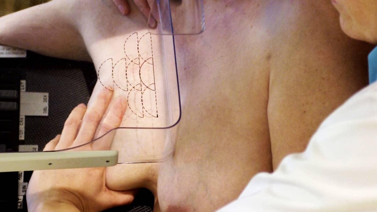 mammografiatutkimus