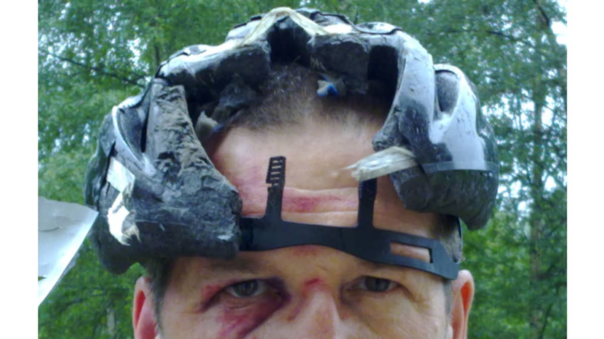 Kuvassa näkyy, kuinka pyöräilykypärä on repeytynyt pään etuosan kohdalta.