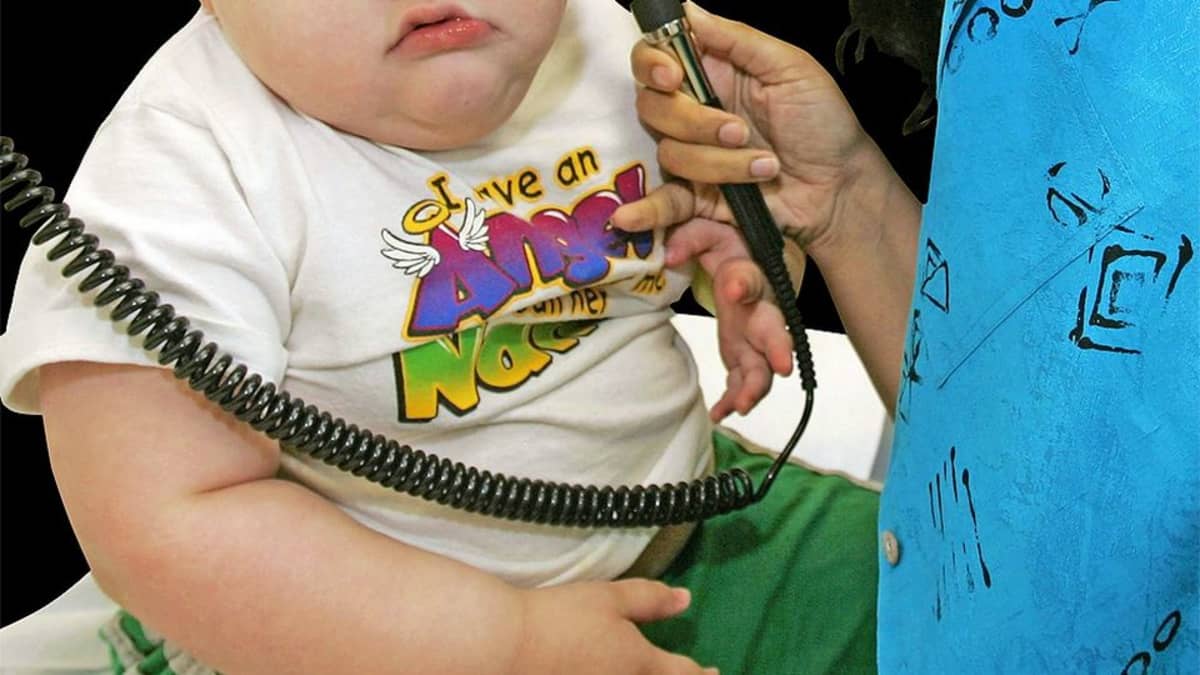 Lihava pieni lapsi lääkärin tutkittavana