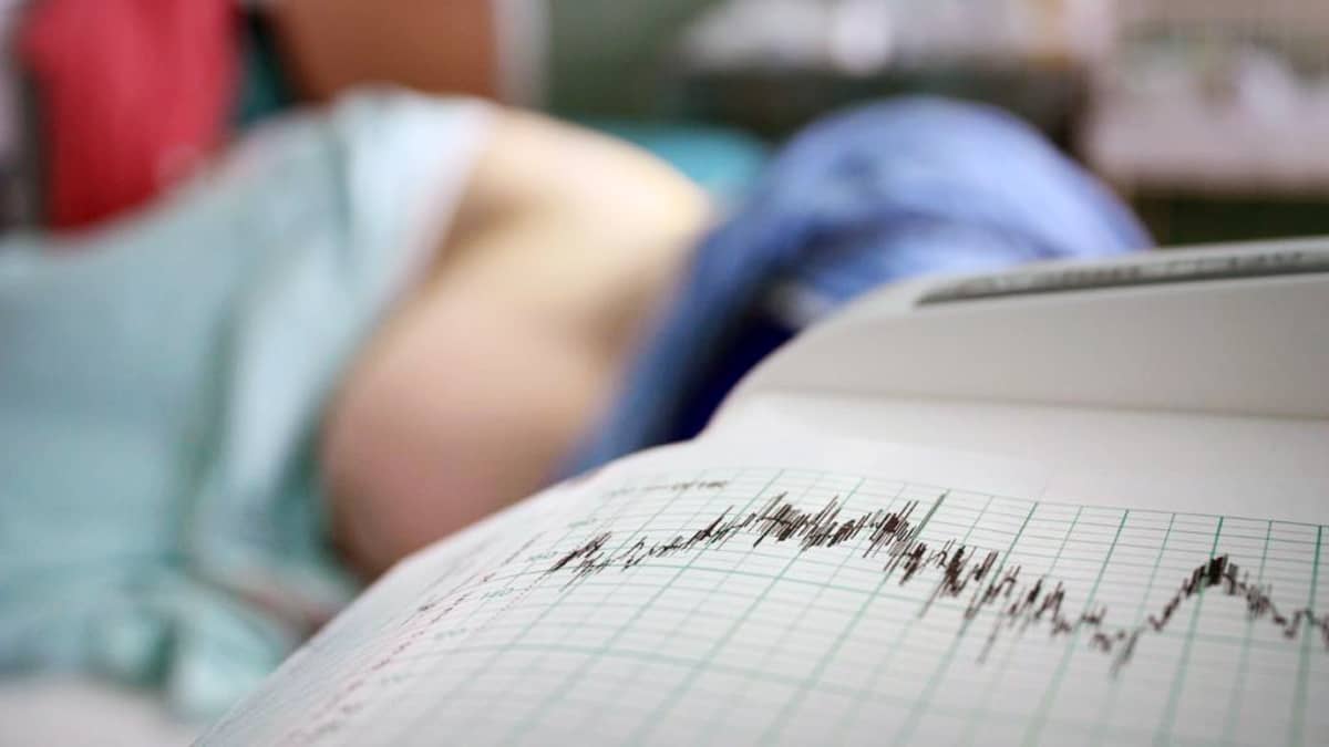 Nainen makaa synnytyssängyssä, kone piirtää paperille vauvan sydänkäyrää.