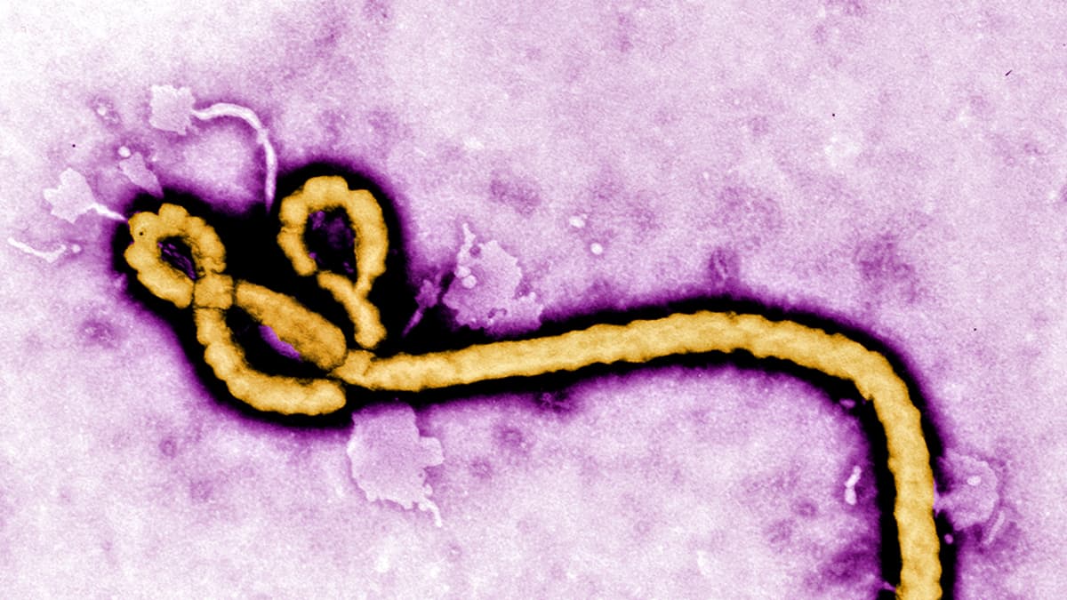 Mikroskooppikuva Ebola viruksesta