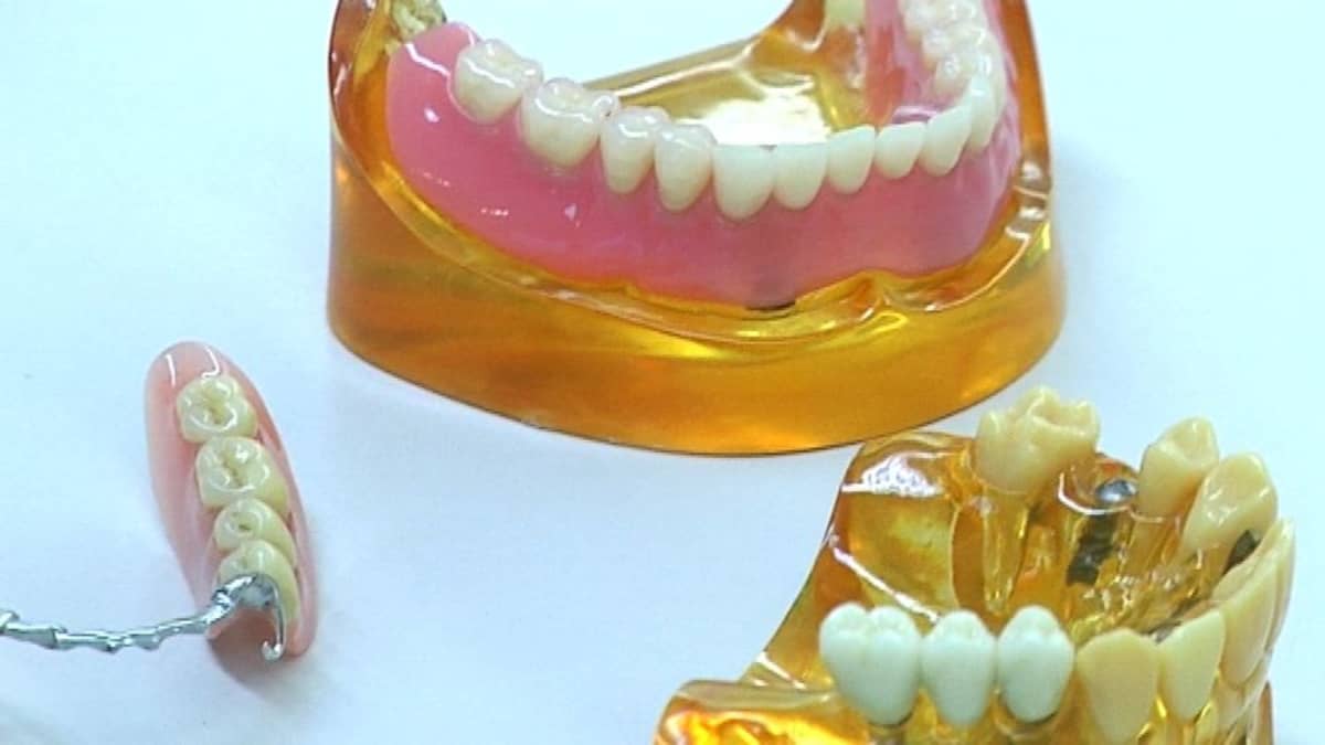 hammasproteeseja
