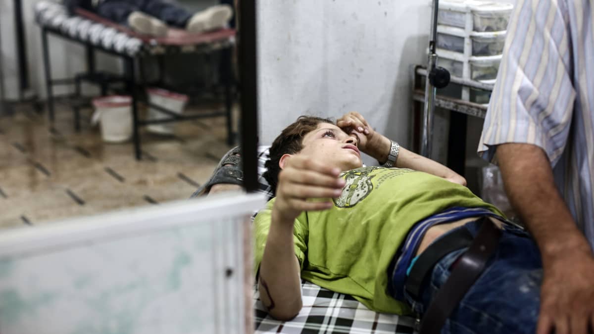 Iskussa haavoittunut lapsi sai apua Douman sairaalassa Syyriassa 21. heinäkuuta 2016. 