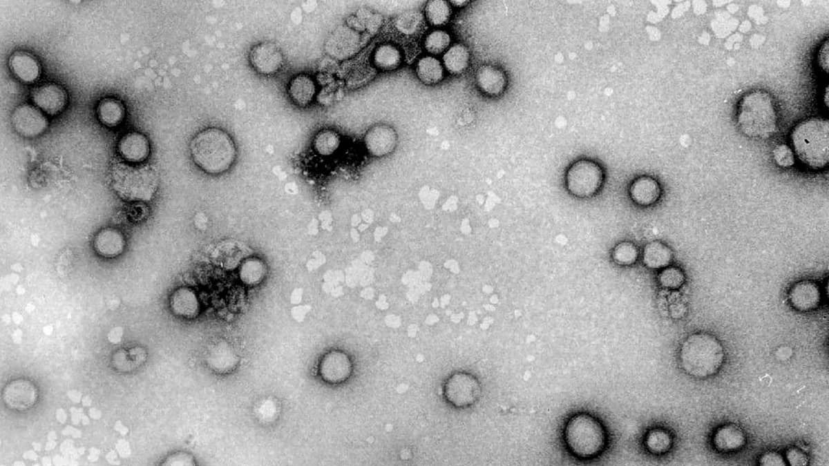 Tältä näyttää influenssa A -virus. Kuva on 60 000-kertainen suurennos.