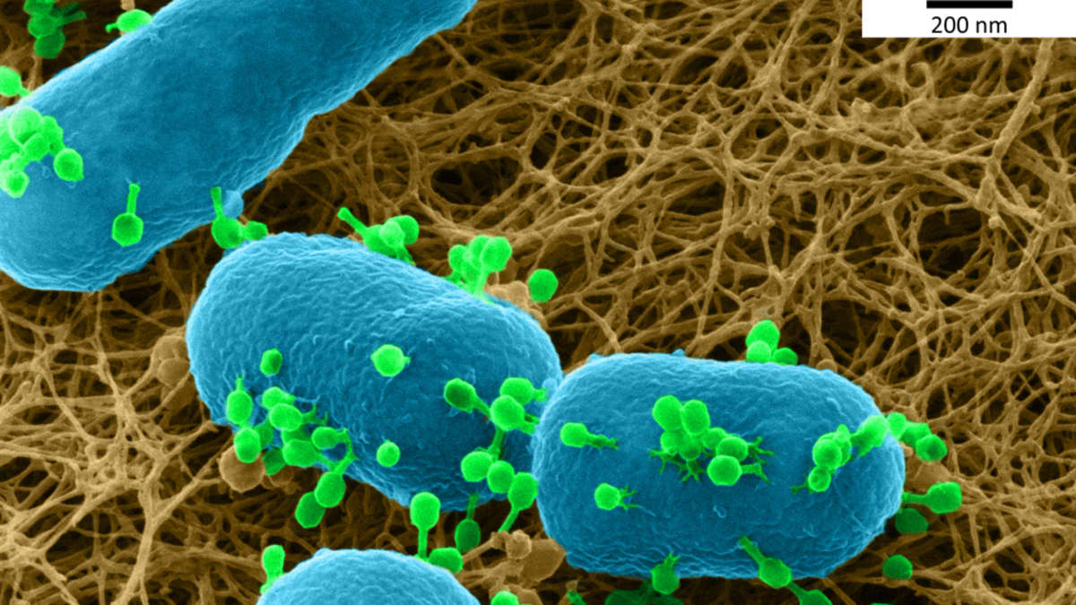 Mikroskooppikuva faagista ja bakteerista.