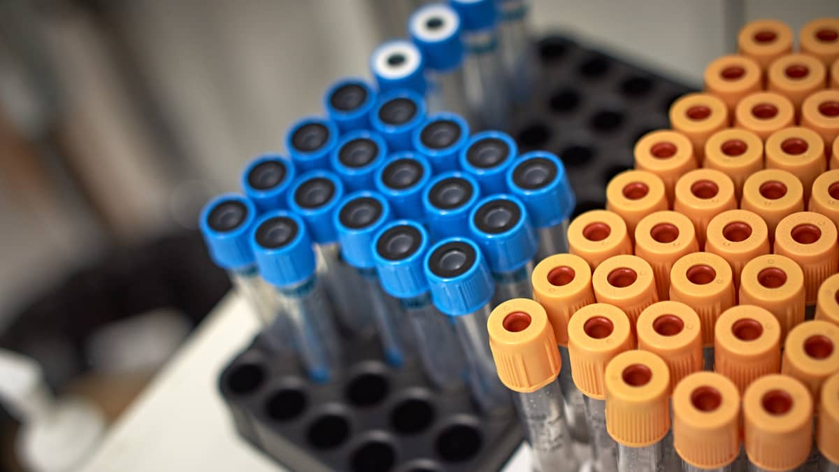 laboratorion näyteputkia