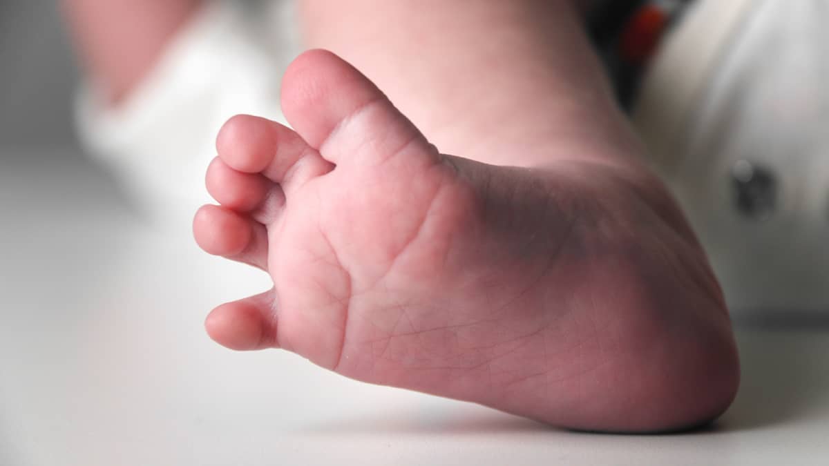 Vauvalle vakavat vammat – poliisi epäilee vanhempia ravistelusta | Yle  Uutiset