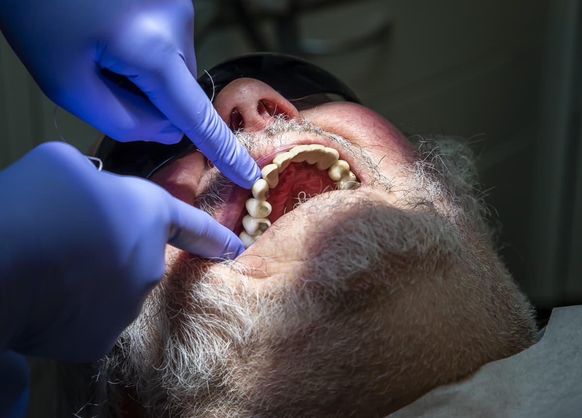 Hammaslääkäri tarkistaa sormillaan potilaan hampaita.