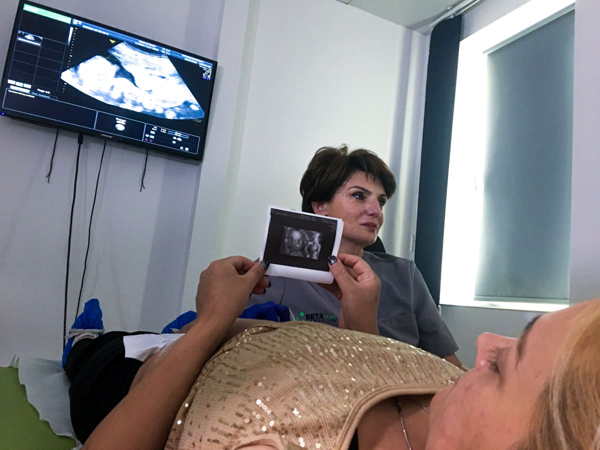 Raskaana oleva nainen katselee ultraäänikuvaa sikiöstään.