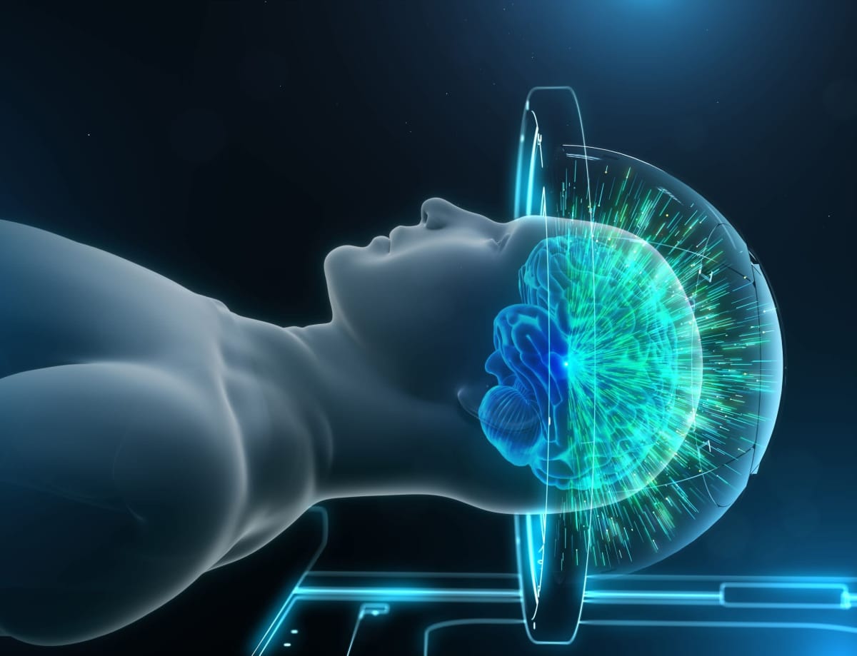 Havainnekuvassa näkyy, miten aivoja hoiudetaan ultraäänellä.