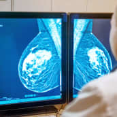 lääkäri tutkii mammografia-kuvia