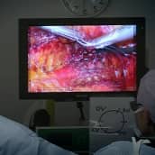 etrauhasleikkaus 3D-tekniikalla Seinäjoen keskussairaalassa