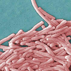 Elektronimikroskooppilla otettu 8000-kertainen suurennus Legionella Pneumophila -bakteerista.